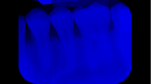 ebfenet_x-ray.png SwapBRGBlue